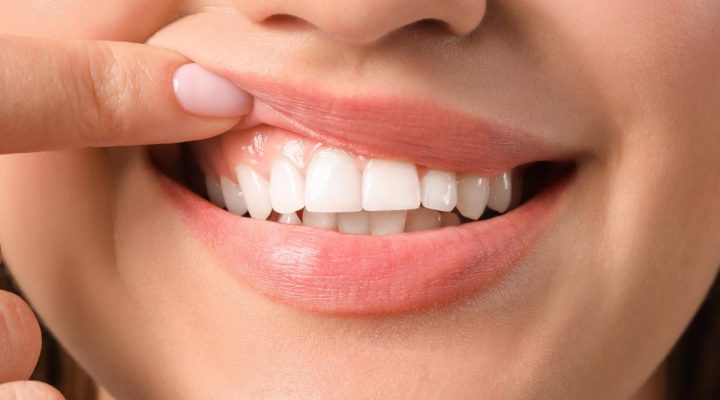 Cómo se trata la Amelogénesis imperfecta en Dental Millán, tu dentista en Cuenca te lo contamos