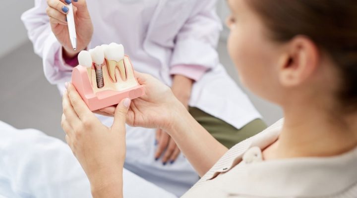 implantes cigomaticos-Millán
