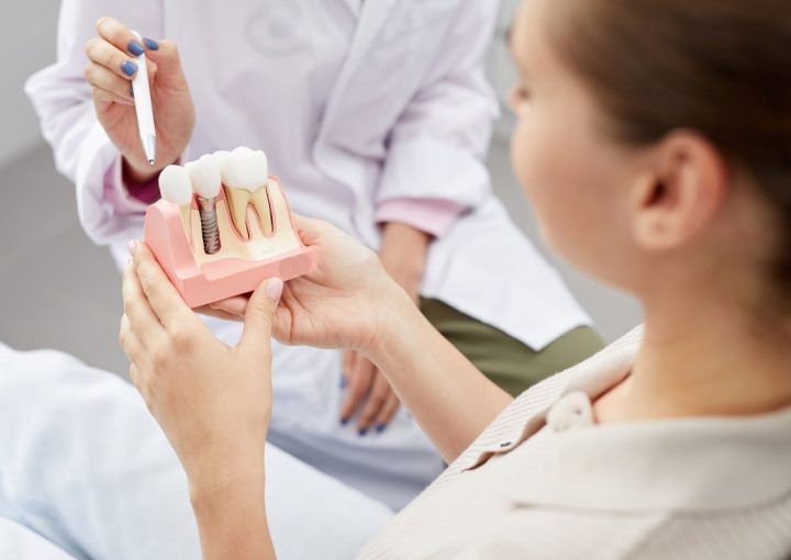 implantes cigomaticos-Millán