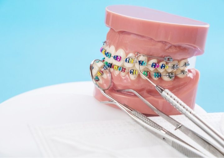 Razones clave para usar ortodoncia